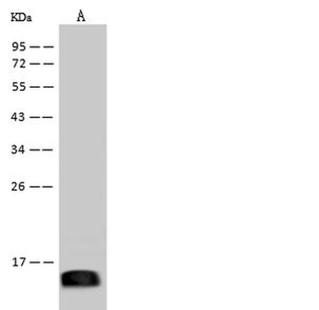 Zika Virus Envelope (Domain III) (strain Zika SPH2015) Antibody in Western Blot (WB)