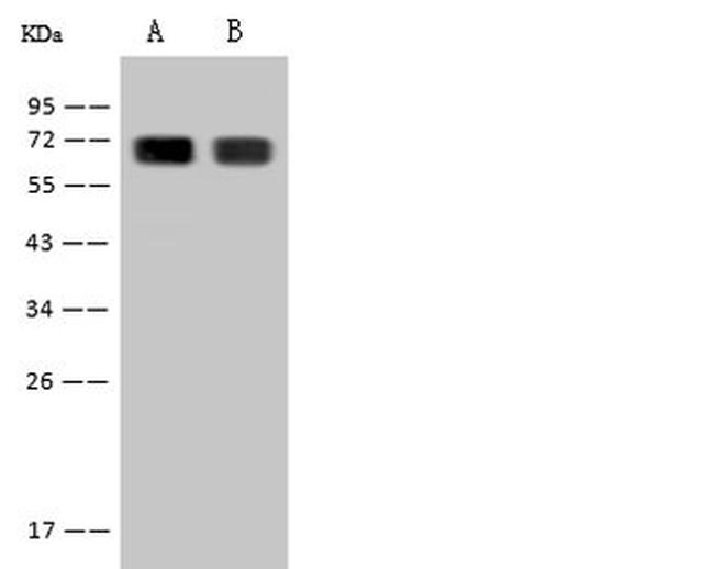 Hemopexin Antibody in Western Blot (WB)