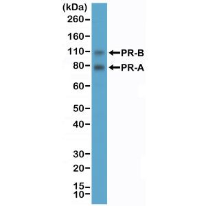 Progesterone Receptor Antibody in Western Blot (WB)