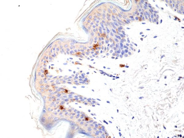 CD1a Antibody in Immunohistochemistry (Paraffin) (IHC (P))