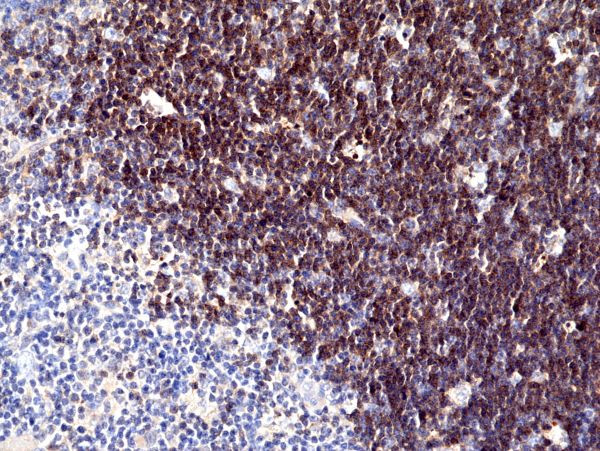 CD1a Antibody in Immunohistochemistry (Paraffin) (IHC (P))