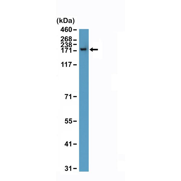 CPS1 Antibody in Western Blot (WB)