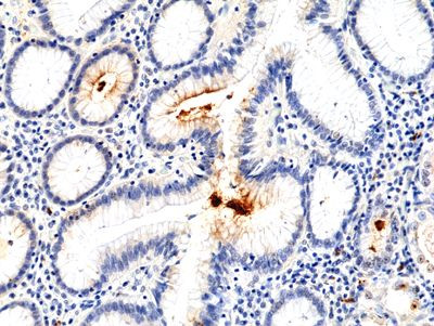 Helicobacter pylori Antibody in Immunohistochemistry (Paraffin) (IHC (P))