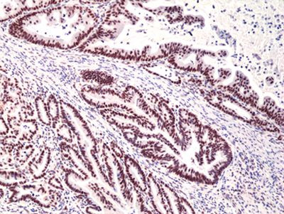 MSH3 Antibody in Immunohistochemistry (Paraffin) (IHC (P))