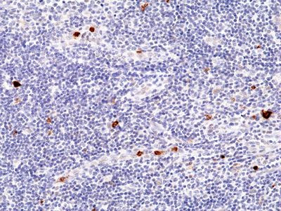 Myeloperoxidase Antibody in Immunohistochemistry (Paraffin) (IHC (P))