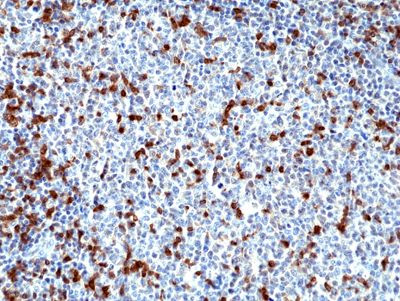 Zap-70 Antibody in Immunohistochemistry (Paraffin) (IHC (P))