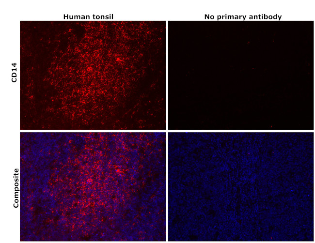 CD14 Antibody in Immunohistochemistry (Paraffin) (IHC (P))