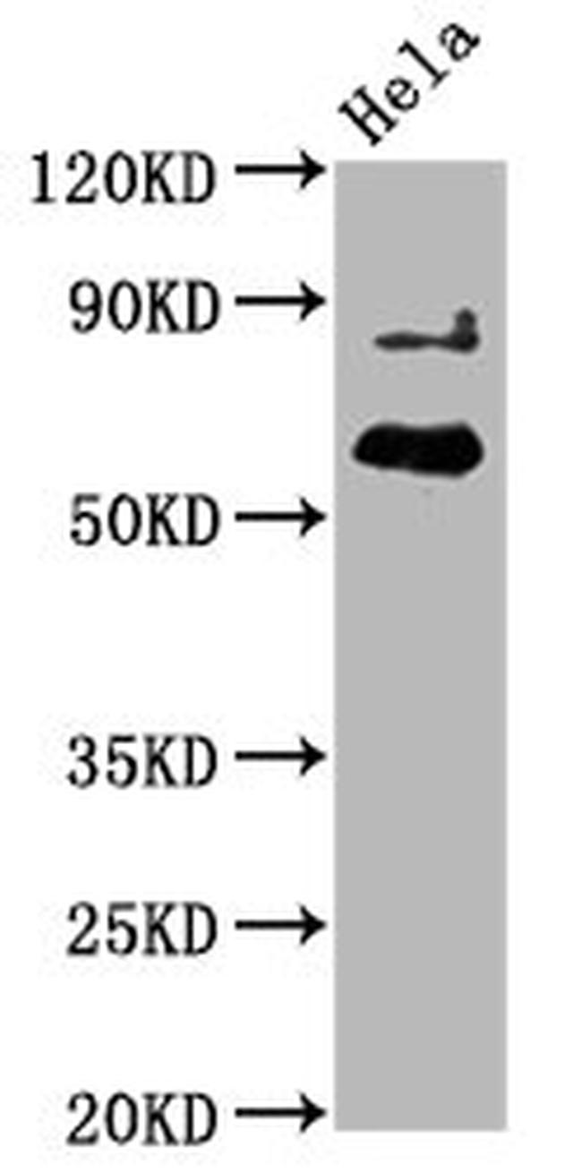 Phospho-AKT1 (Thr450) Antibody in Western Blot (WB)