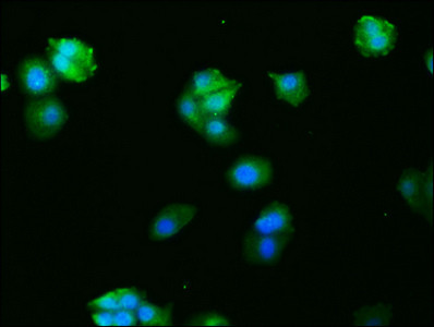 c-Fos Antibody in Immunocytochemistry (ICC/IF)