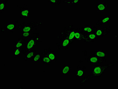 H3K4me2 Antibody in Immunocytochemistry (ICC/IF)