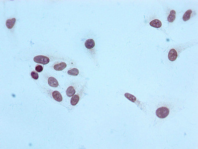 H4K20me3 Antibody in Immunocytochemistry (ICC/IF)