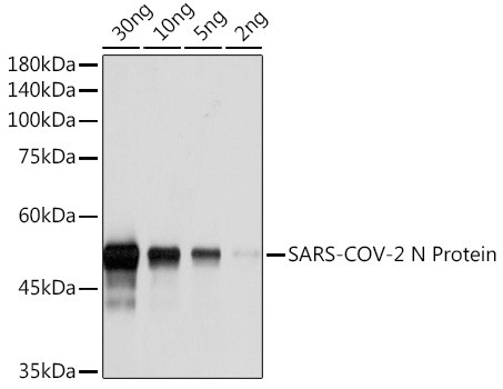 SARS-CoV-2 Nucleocapsid Antibody in Western Blot (WB)