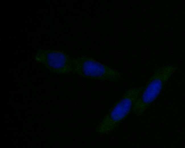 DFNA5 Antibody in Immunocytochemistry (ICC/IF)