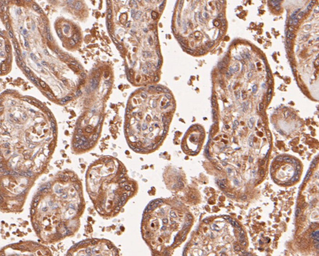 DFNA5 Antibody in Immunohistochemistry (Paraffin) (IHC (P))