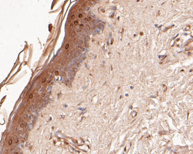 DFNA5 Antibody in Immunohistochemistry (Paraffin) (IHC (P))