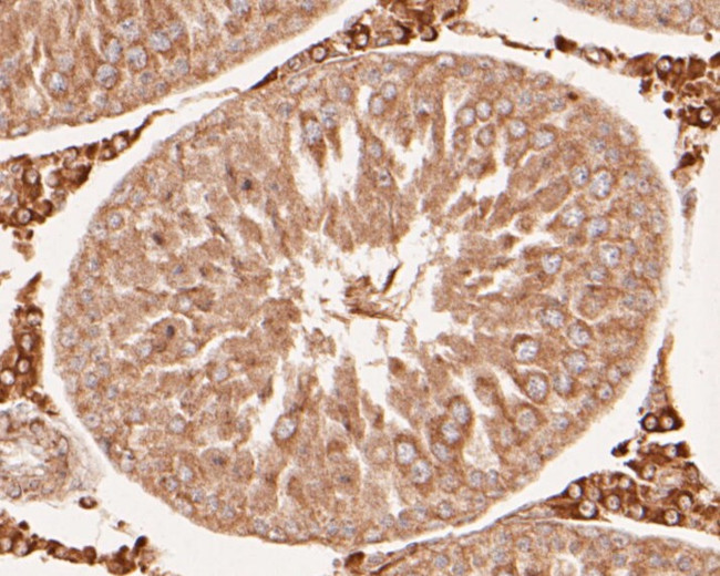 DFNA5 Antibody in Immunohistochemistry (Paraffin) (IHC (P))