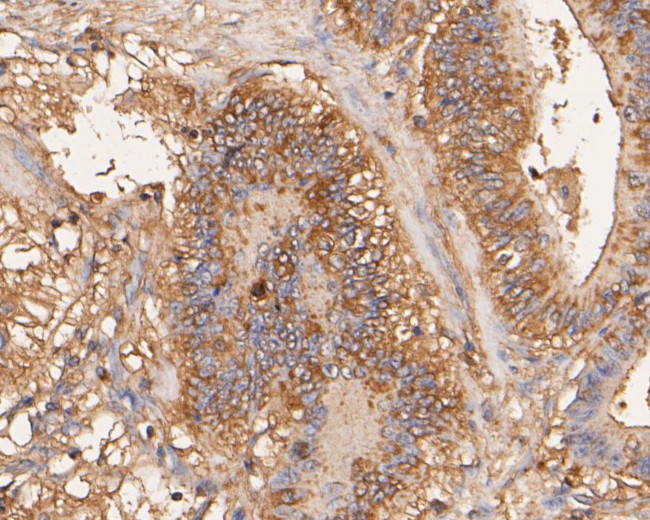 Aspartate Aminotransferase, Cytoplasmic Antibody in Immunohistochemistry (Paraffin) (IHC (P))