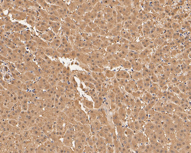 Aspartate Aminotransferase, Cytoplasmic Antibody in Immunohistochemistry (Paraffin) (IHC (P))