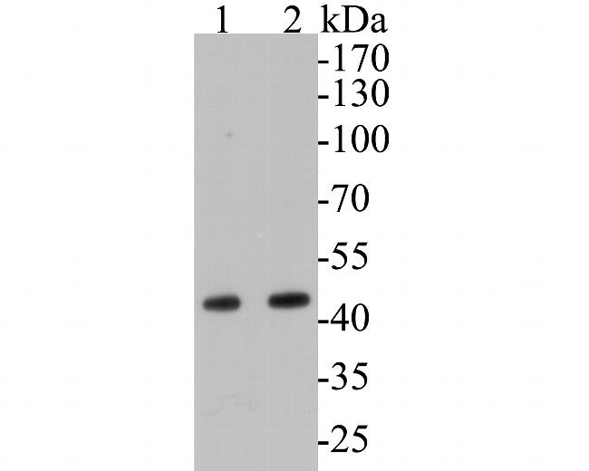 Aspartate Aminotransferase, Cytoplasmic Antibody in Western Blot (WB)