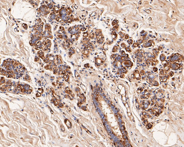 alpha Actinin Antibody in Immunohistochemistry (Paraffin) (IHC (P))