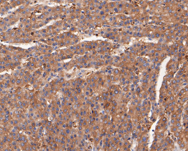 alpha Actinin Antibody in Immunohistochemistry (Paraffin) (IHC (P))