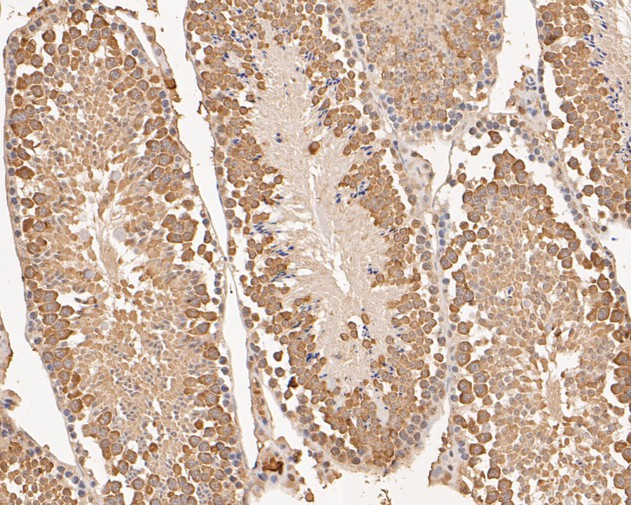 RUVBL2 Antibody in Immunohistochemistry (Paraffin) (IHC (P))