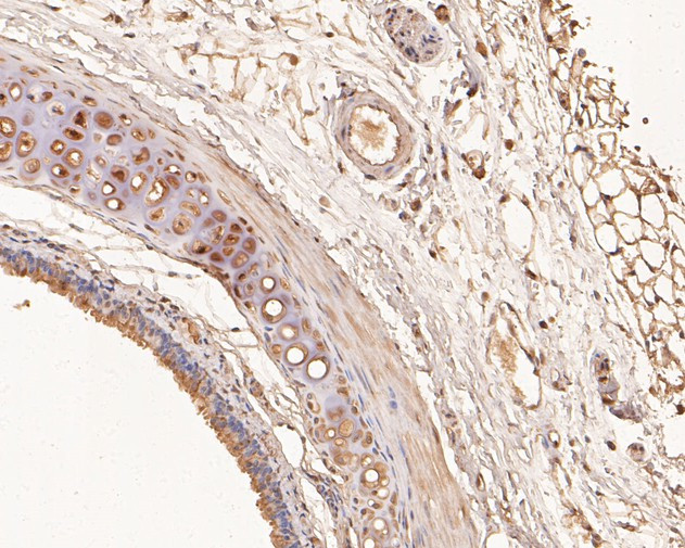 RUVBL2 Antibody in Immunohistochemistry (Paraffin) (IHC (P))