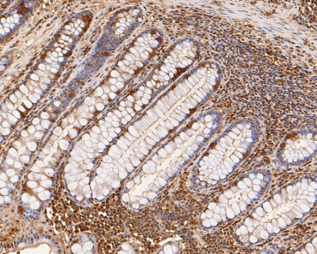 RUVBL2 Antibody in Immunohistochemistry (Paraffin) (IHC (P))