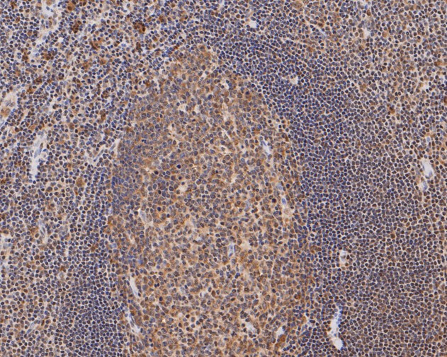 RUVBL2 Antibody in Immunohistochemistry (Paraffin) (IHC (P))