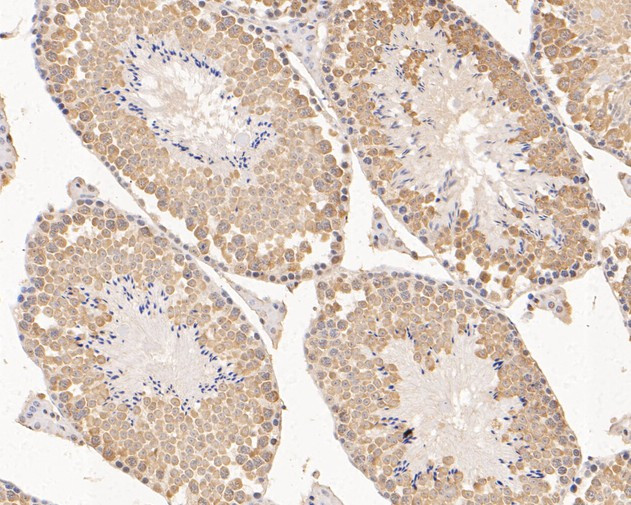 RUVBL2 Antibody in Immunohistochemistry (Paraffin) (IHC (P))