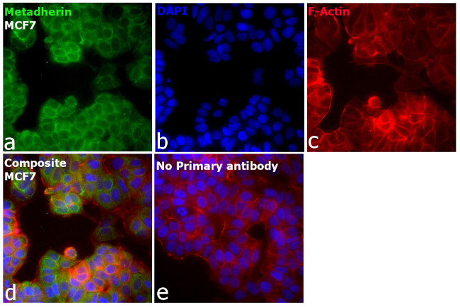 LYRIC Antibody in Immunocytochemistry (ICC/IF)