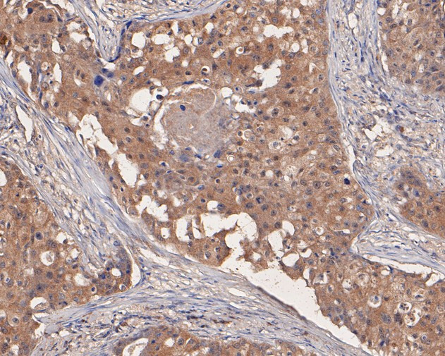 UBA3 Antibody in Immunohistochemistry (Paraffin) (IHC (P))