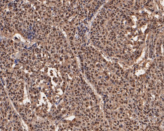 UBA3 Antibody in Immunohistochemistry (Paraffin) (IHC (P))