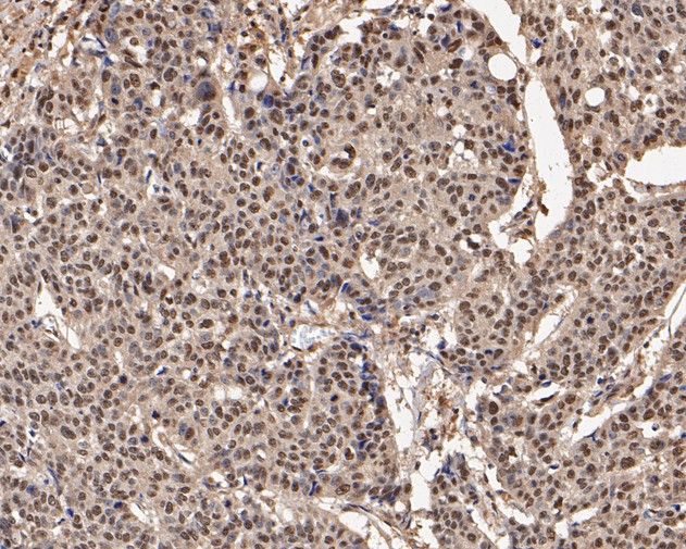 UBA3 Antibody in Immunohistochemistry (Paraffin) (IHC (P))