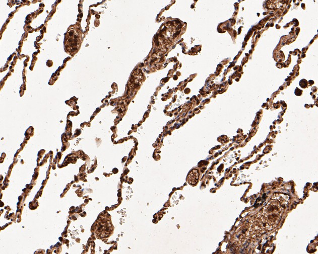 UBA3 Antibody in Immunohistochemistry (Paraffin) (IHC (P))