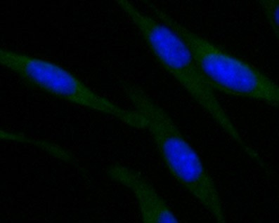 ROBO1 Antibody in Immunocytochemistry (ICC/IF)