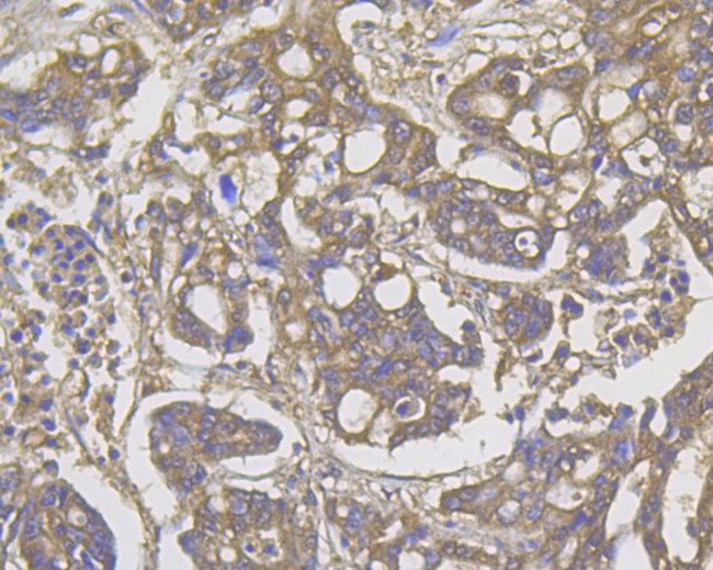 ROBO1 Antibody in Immunohistochemistry (Paraffin) (IHC (P))