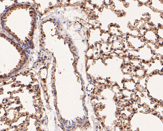 Annexin A3 Antibody in Immunohistochemistry (Paraffin) (IHC (P))