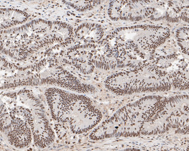 MTA2 Antibody in Immunohistochemistry (Paraffin) (IHC (P))