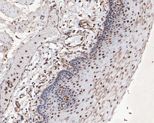 MTA2 Antibody in Immunohistochemistry (Paraffin) (IHC (P))