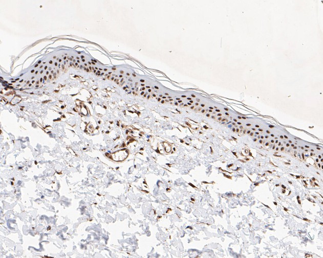 MTA2 Antibody in Immunohistochemistry (Paraffin) (IHC (P))