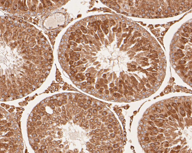 NFKB2 Antibody in Immunohistochemistry (Paraffin) (IHC (P))