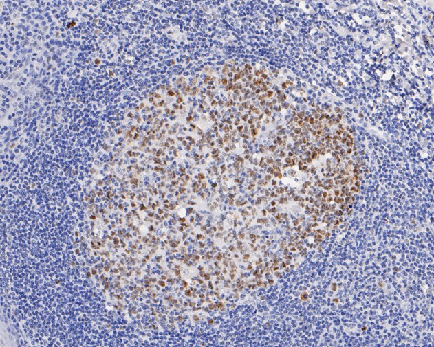 DNMT1 Antibody in Immunohistochemistry (Paraffin) (IHC (P))