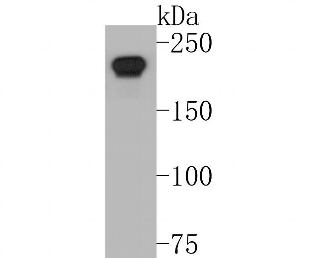 DNMT1 Antibody in Western Blot (WB)