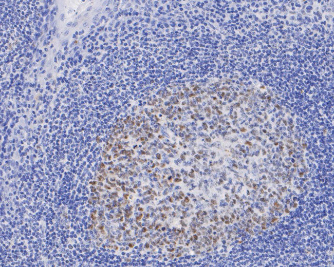 DNMT1 Antibody in Immunohistochemistry (Paraffin) (IHC (P))