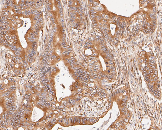 Cytokeratin 20 Antibody in Immunohistochemistry (Paraffin) (IHC (P))