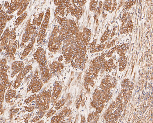 Cytokeratin 20 Antibody in Immunohistochemistry (Paraffin) (IHC (P))