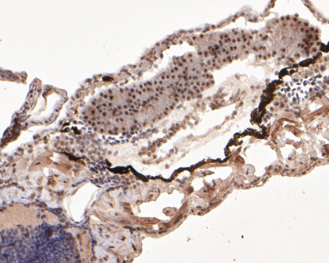 DDX24 Antibody in Immunohistochemistry (Paraffin) (IHC (P))