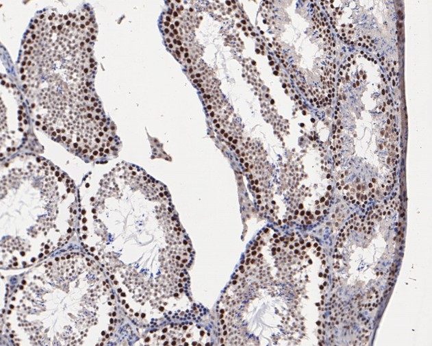 HMGB2 Antibody in Immunohistochemistry (Paraffin) (IHC (P))