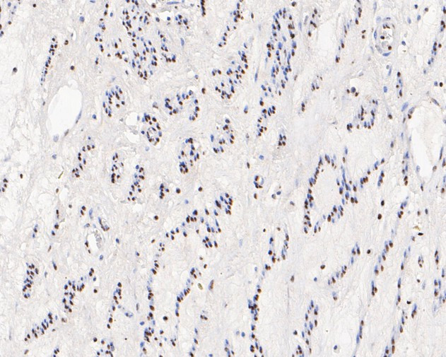 HMGB2 Antibody in Immunohistochemistry (Paraffin) (IHC (P))